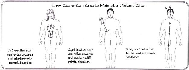 Scars and tatoos
